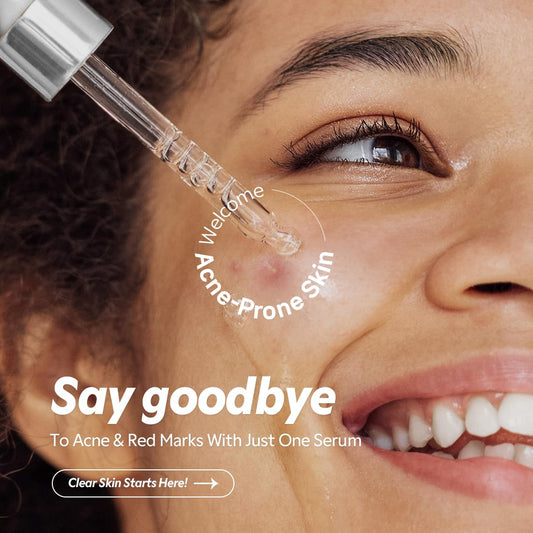 TIRTIR - Azelaic Acid 12% Serum