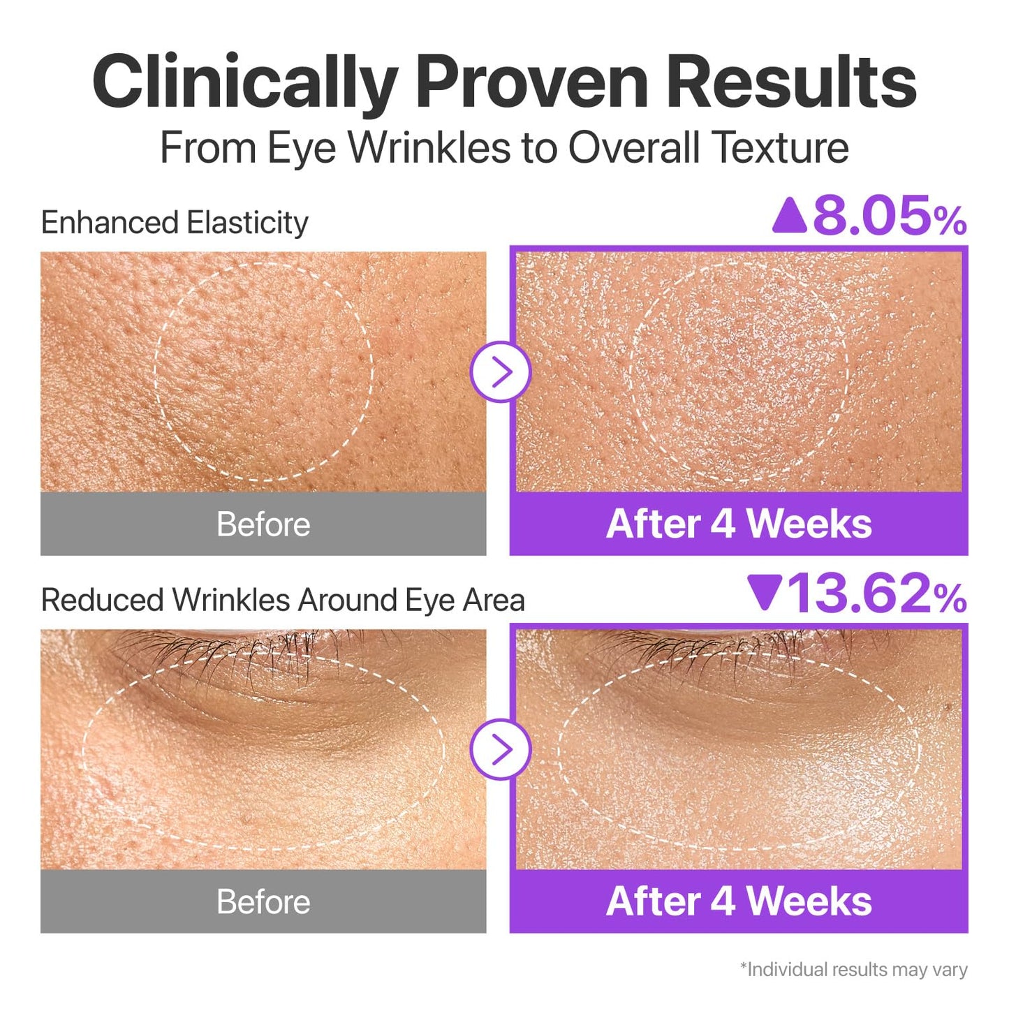 numbuzin - No.9 NAD Bio Lifting-sil Essence