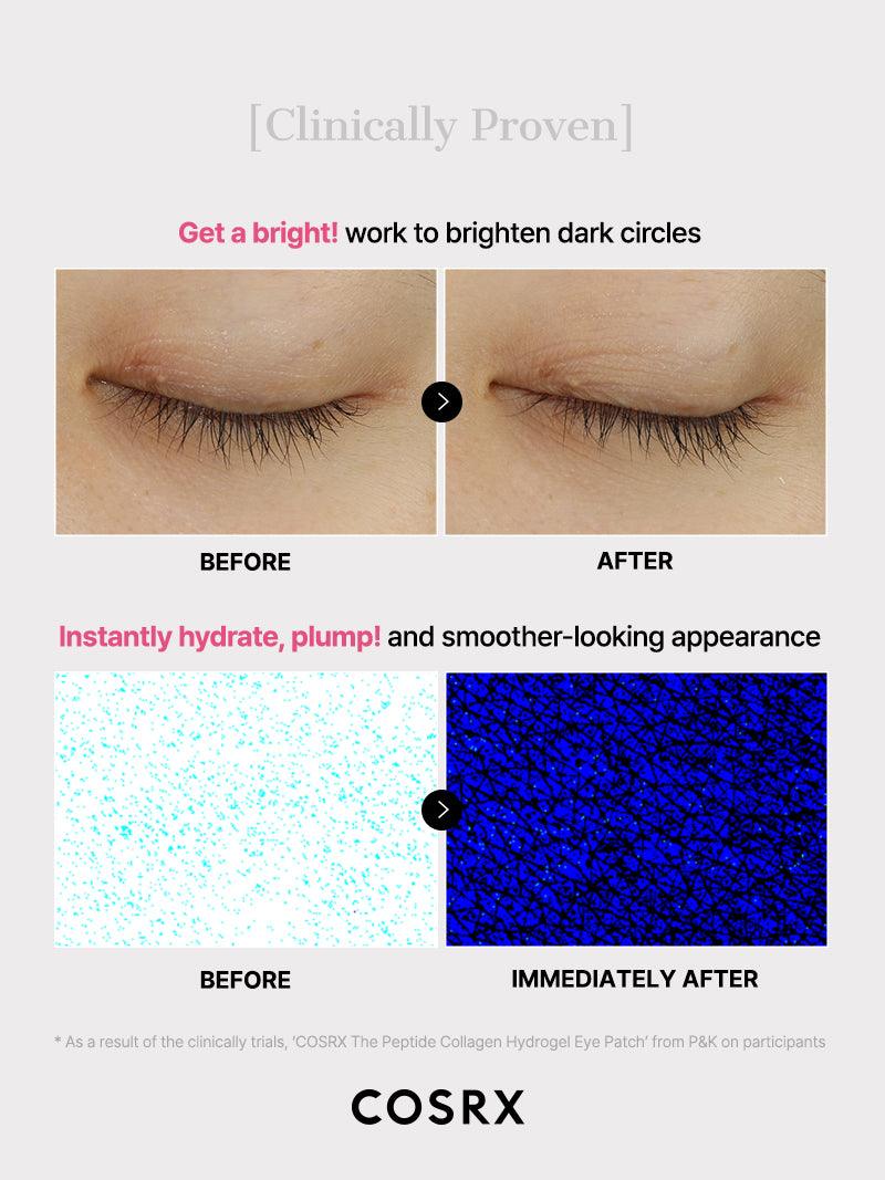 Cosrx - THE PEPTIDE COLLAGEN HYDROGEL EYE PATCH