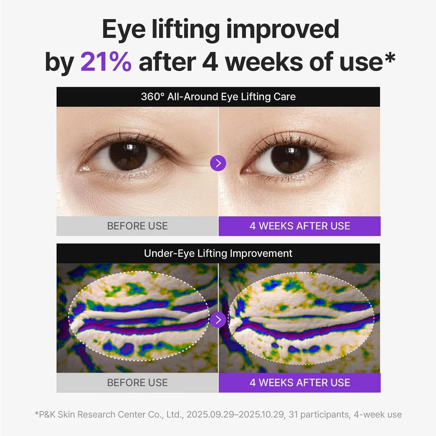 Centellian24 - 360º Shot PDRN lifting Eye cream