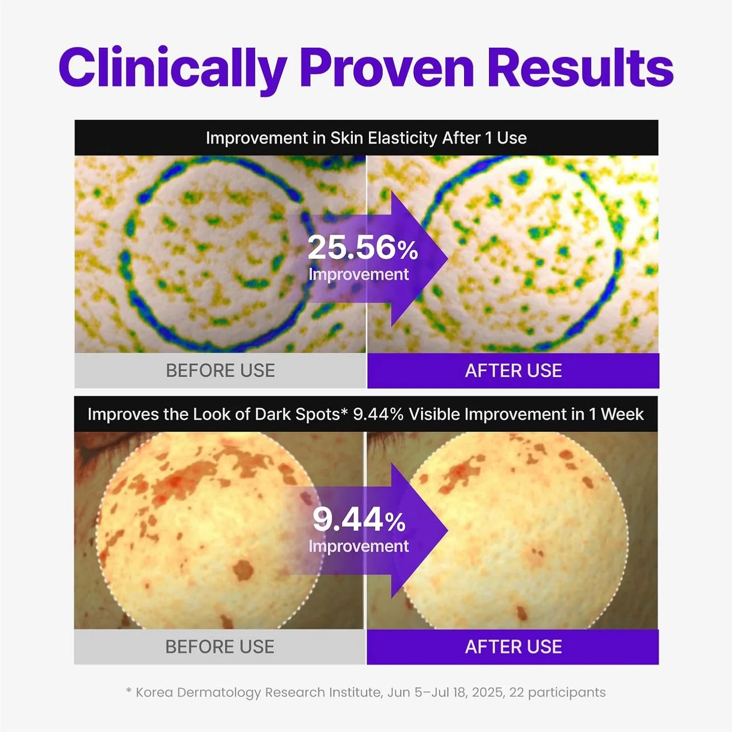 Centellian24 - Expert Madeca Cream Active Renew PDRN