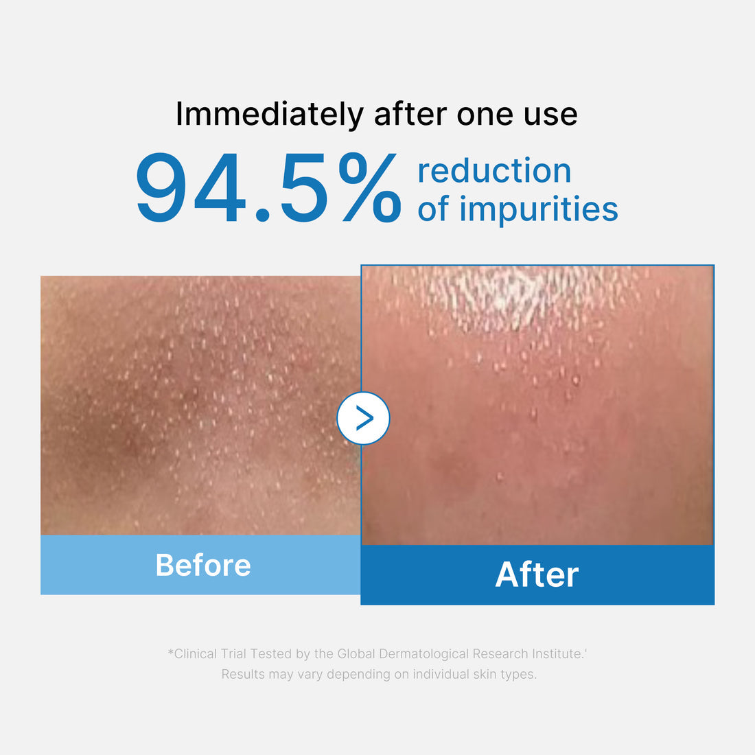 Medicube - Zero Pore Blackhead Deep Cleansing Oil