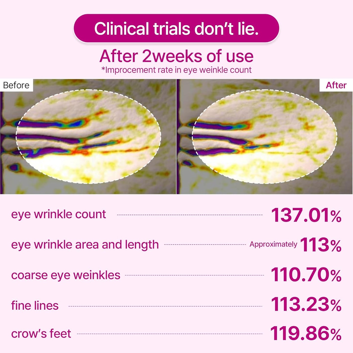 Dr.Melaxin - Cemenrete Calcium Volume Eye Patch