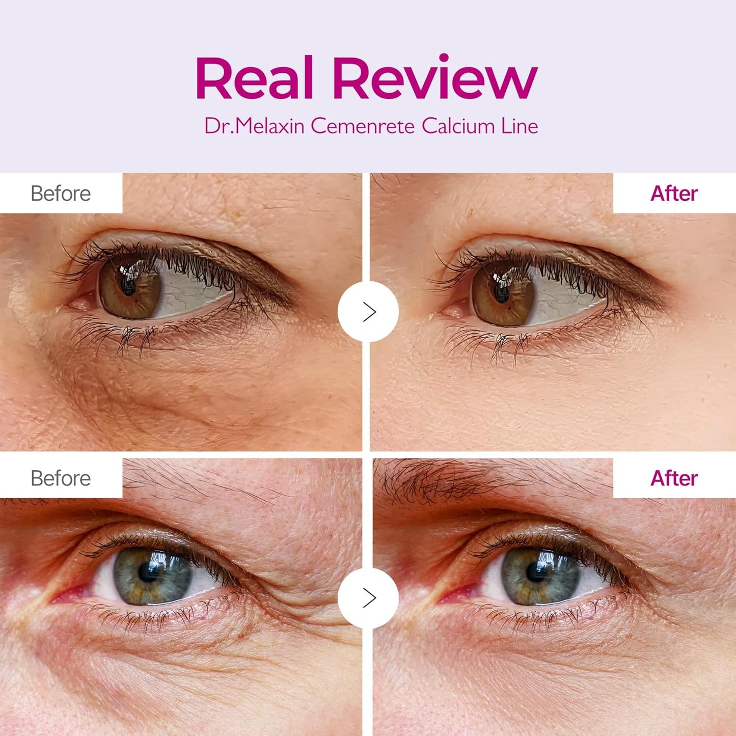 Dr.Melaxin - Cemenrete Calcium Volume Eye Patch