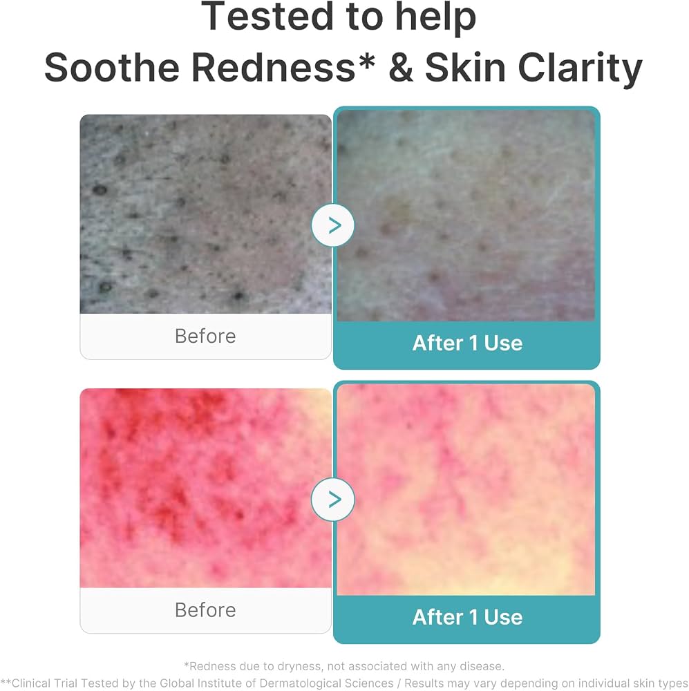 Medicube Azelaic Acid Capsule Foam Cleanser