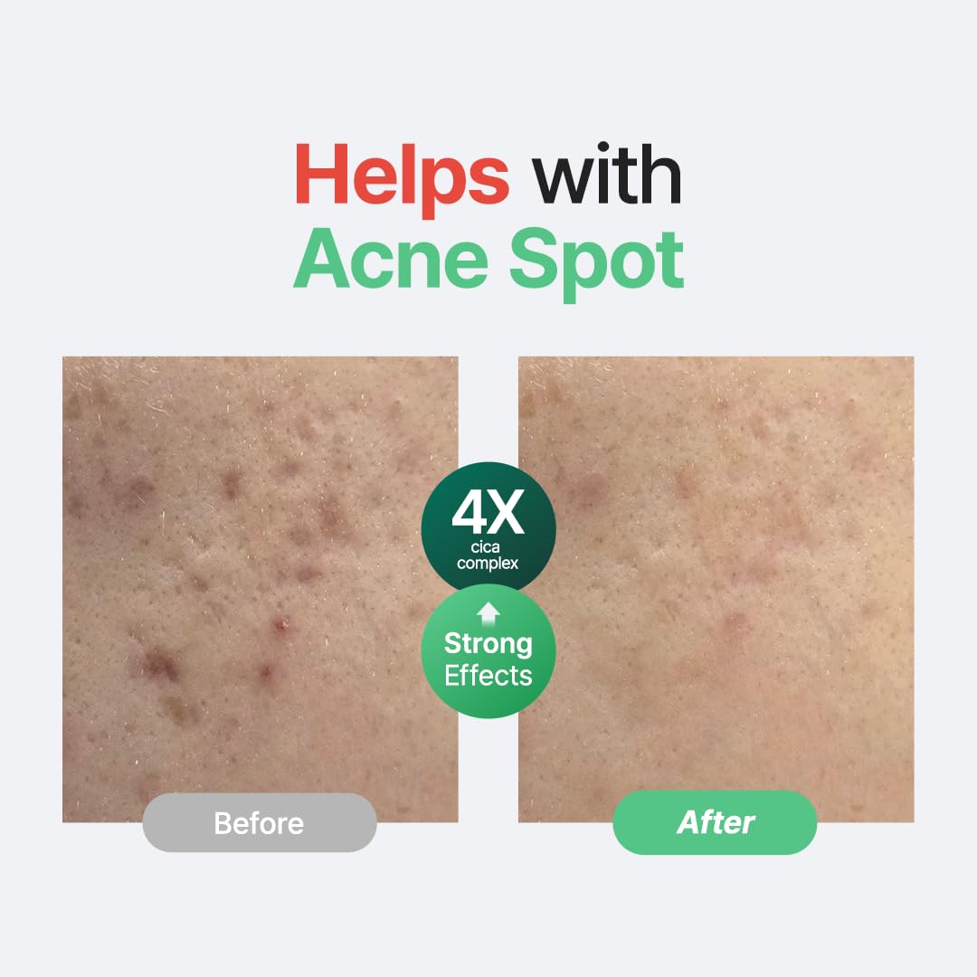 Purito SEOUL - Wonder Releaf Centella Serum Unscented