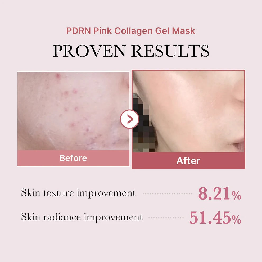 medicube - PDRN Pink Collagen Gel Mask