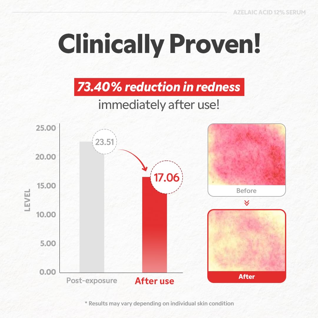TIRTIR - Azelaic Acid 12% Serum