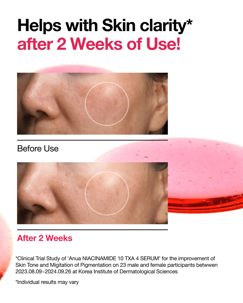 Anua - Niacinamide 10 TXA 4 Serum