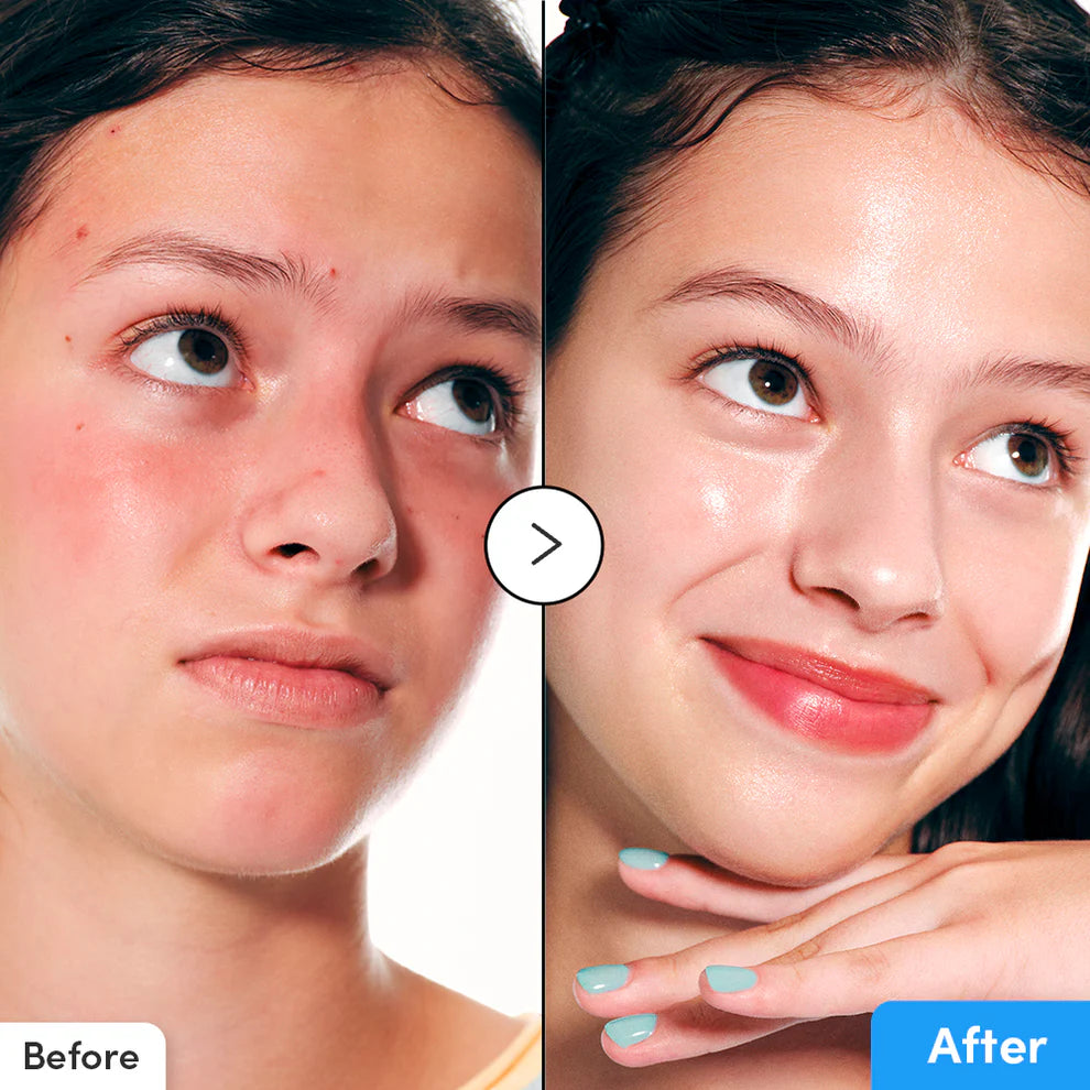 EQQUALBERRY - Hyaltoin Flooding Serum