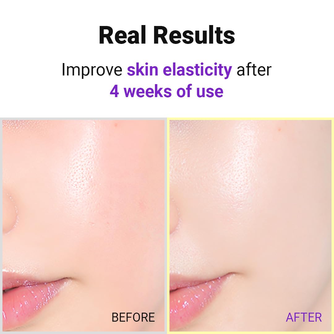 Isntree - Hyper Retinol EX 1.0 Serum