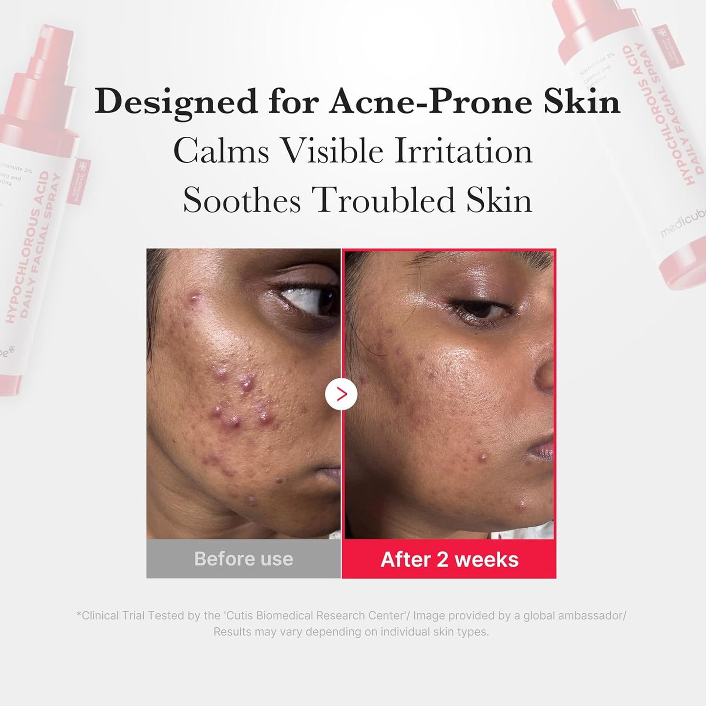 medicube - Hypochlorous Acid Daily Facial Spray